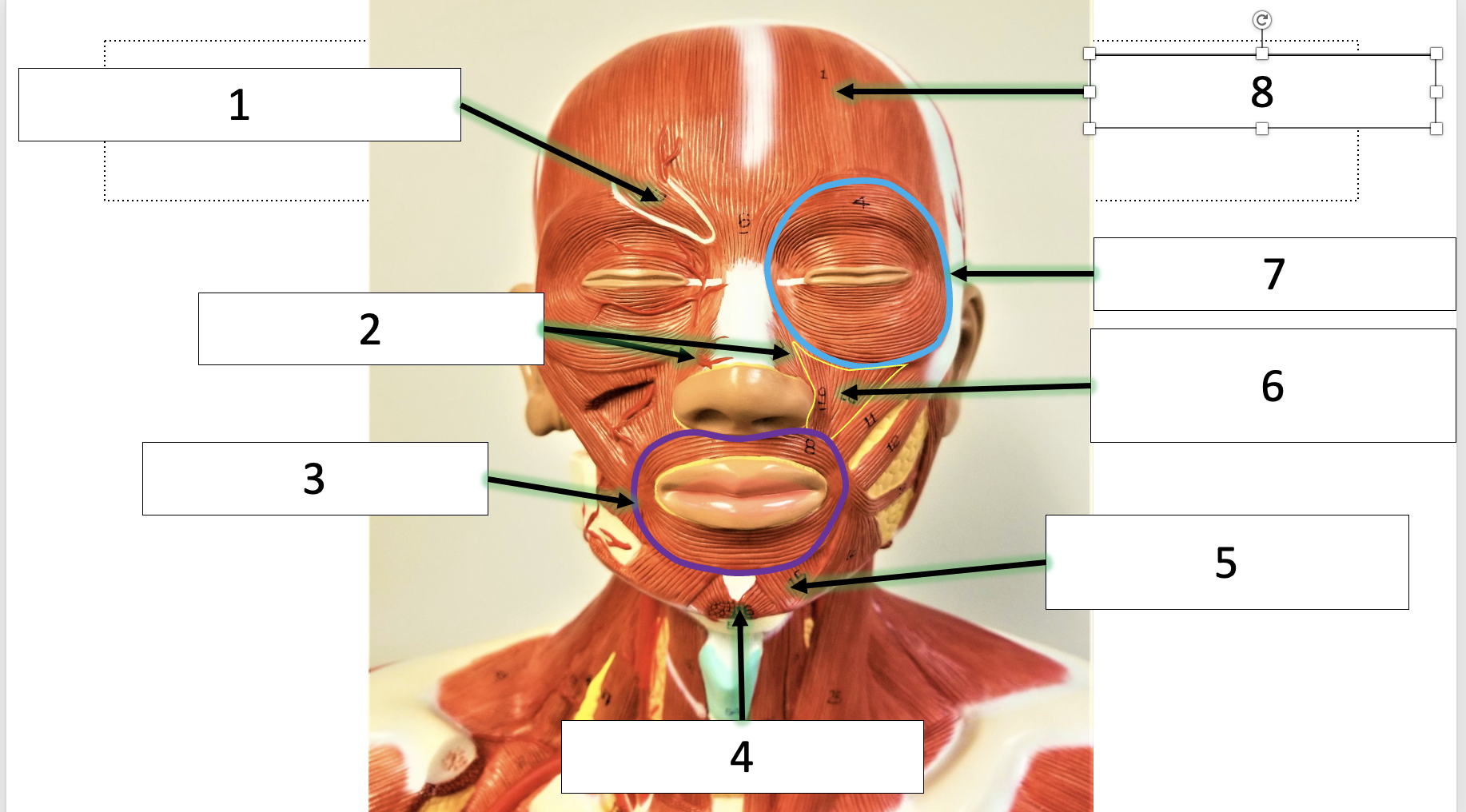 <p>name the muscle (6)</p>