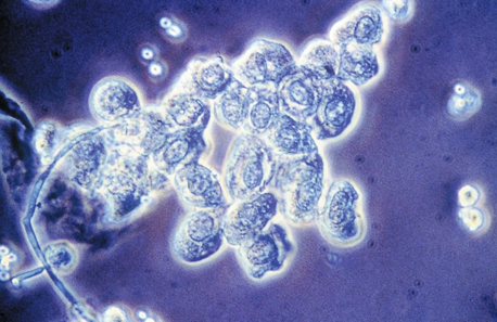 term image