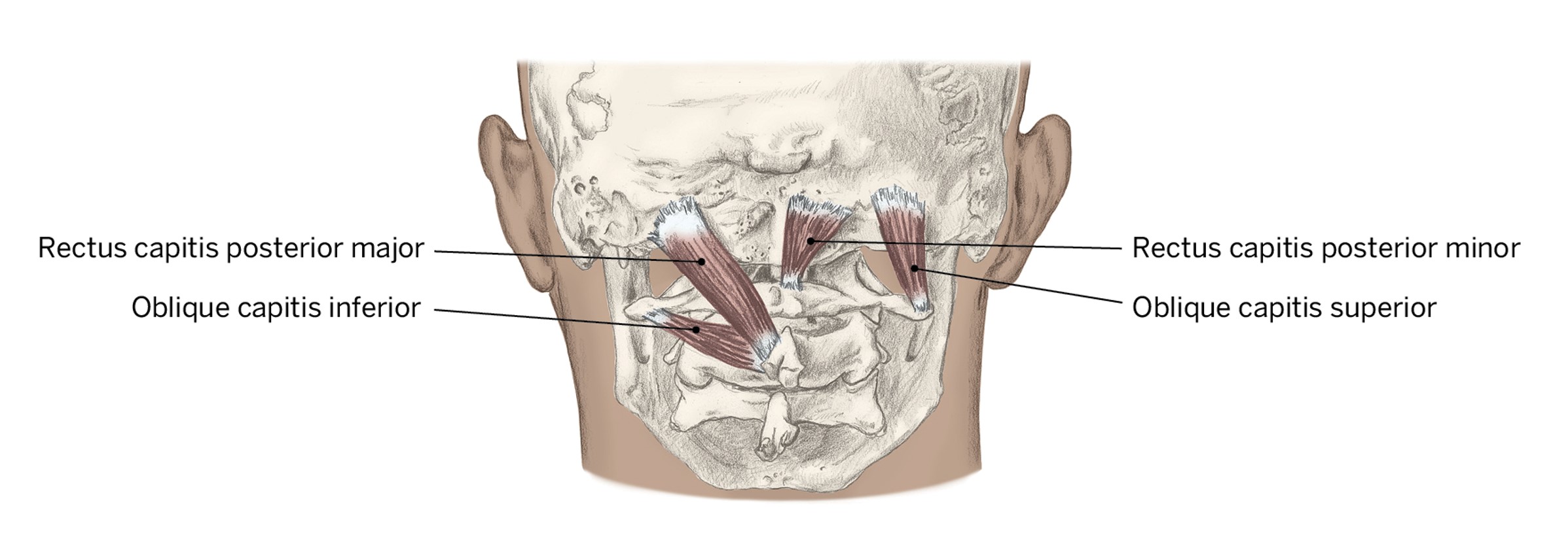 <p>O- C1-C2</p><p>I- Occiput and C1</p><p>A- Head; extension, (ipsilateral) lateral bending, and ipsilateral rotation</p>