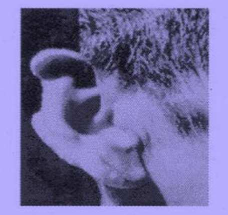 <p>Disease; caused by?</p>
