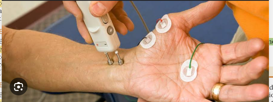 <p>The rate of nerve conduction is evaluated by stimulating the nerve and recording the velocity of conduction to electrodes placed over the muscle. Nerve conduction studies are used to diagnose nerve injuries and neuromuscular disease.</p>