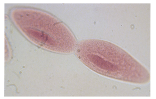 <p><strong><em>Paramecium spp. — </em></strong></p><p>Identify the type of reproduction.</p>