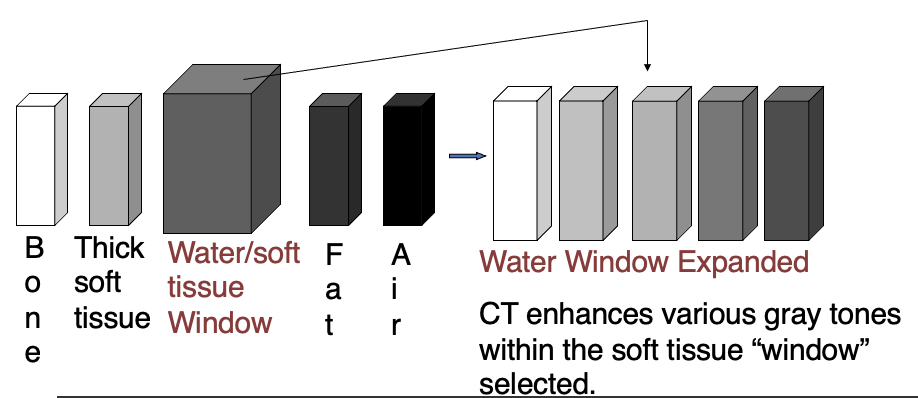 <ul><li><p>Settings That Adjust Visibility (Gray Scale Change)</p><ul><li><p>This Also Specifies The Range Observed</p></li></ul></li></ul><p></p>