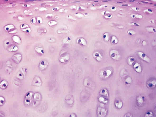 <p>Most common type of cartilage, many spread out circles (not as spread out as blood)</p>