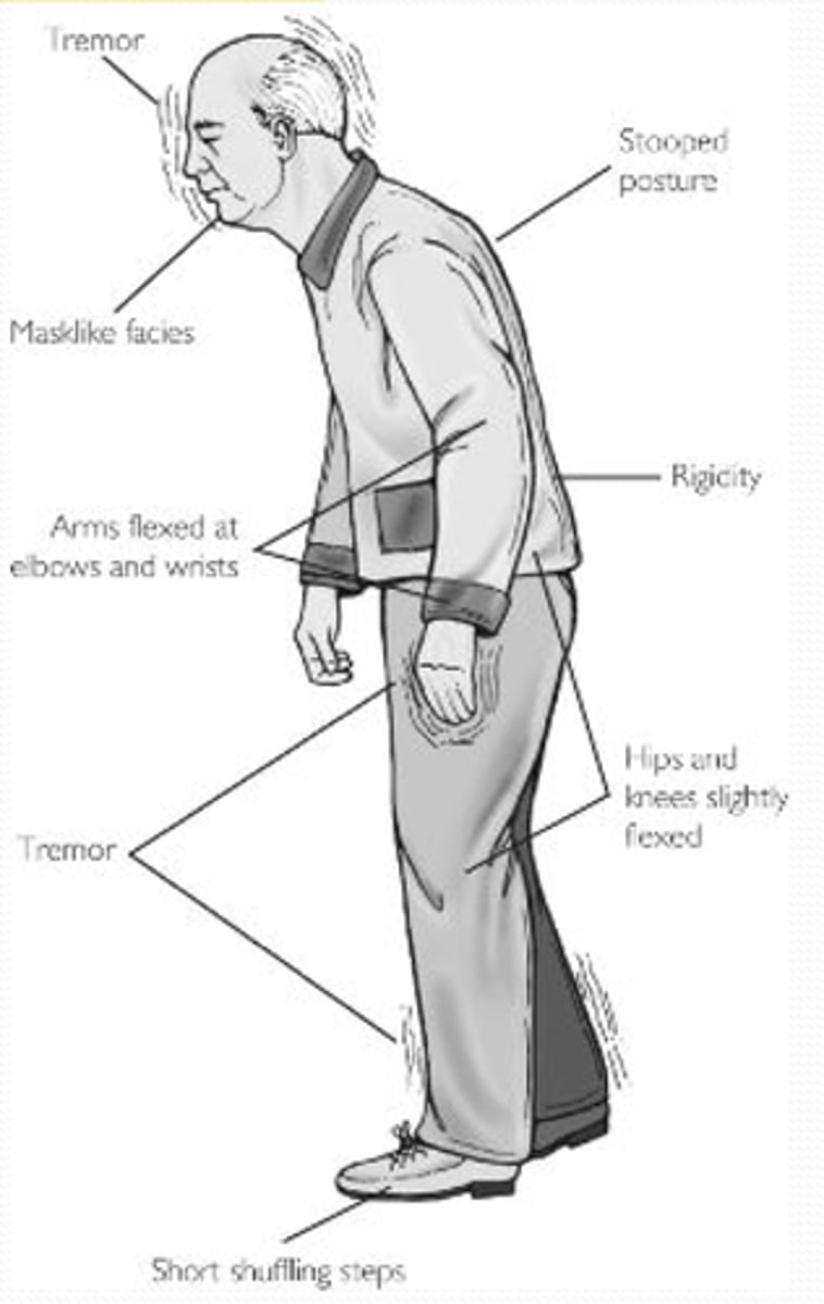 <p>movements are very slow</p>