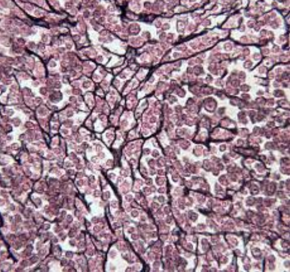 <p>what tissue is this?</p>