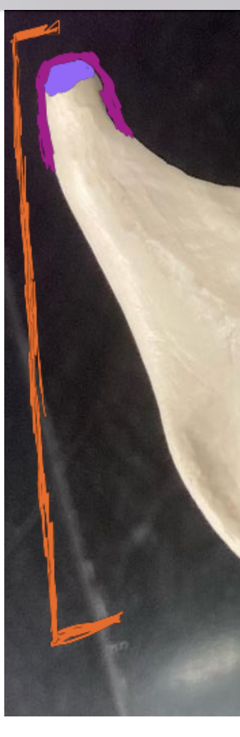 <p>Curves portion of a bone</p>