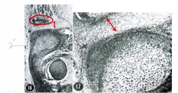 <p>-mandibular bone/dentary so far back extended that it begins to approach the temporal bone and there is motion in lower jaw</p><p>-as a result, secondary cartilage forms</p><p>-no joint space, just intermediate zone (red arrow on right)</p>