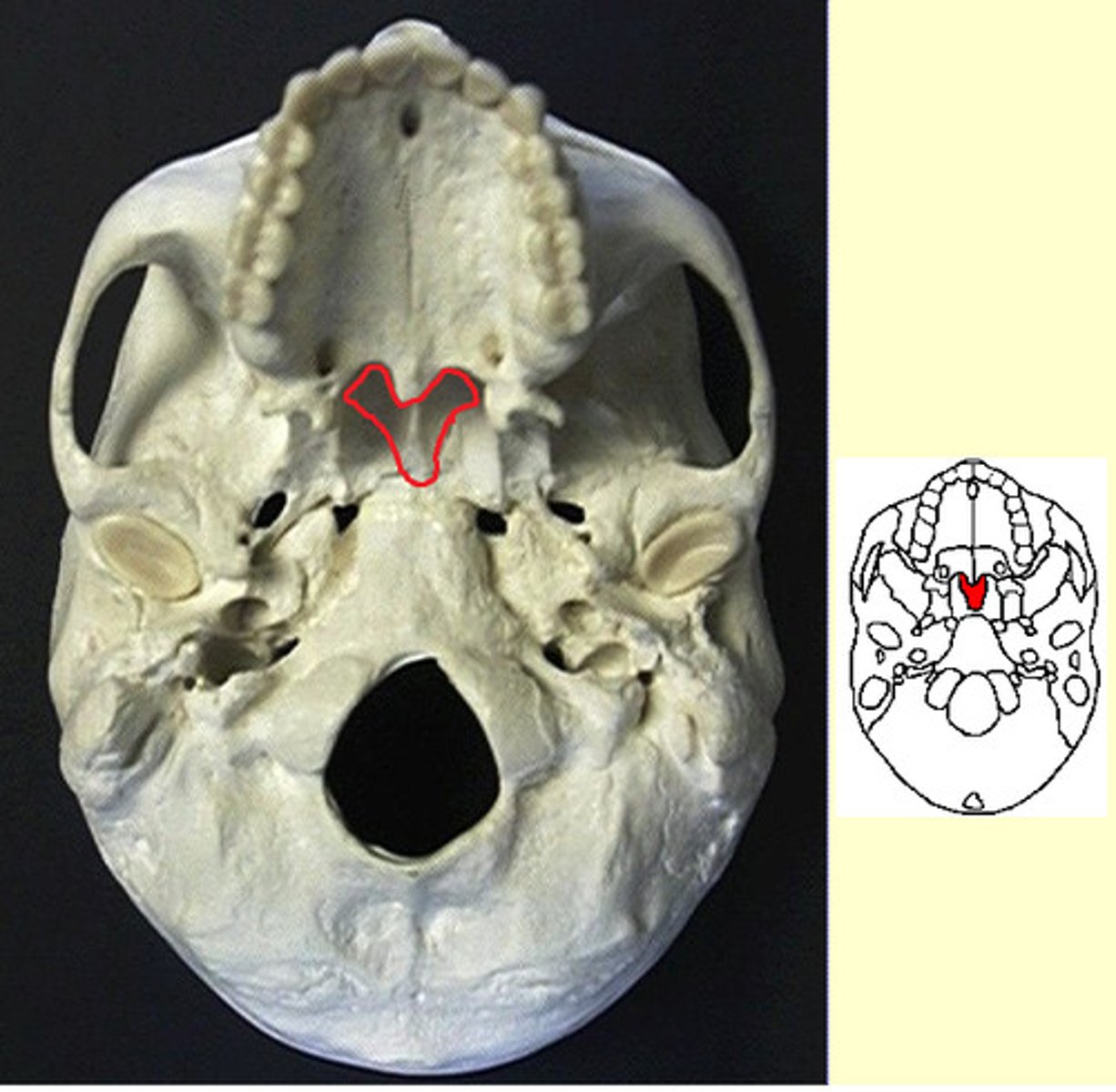 <p>Name the bone.</p>