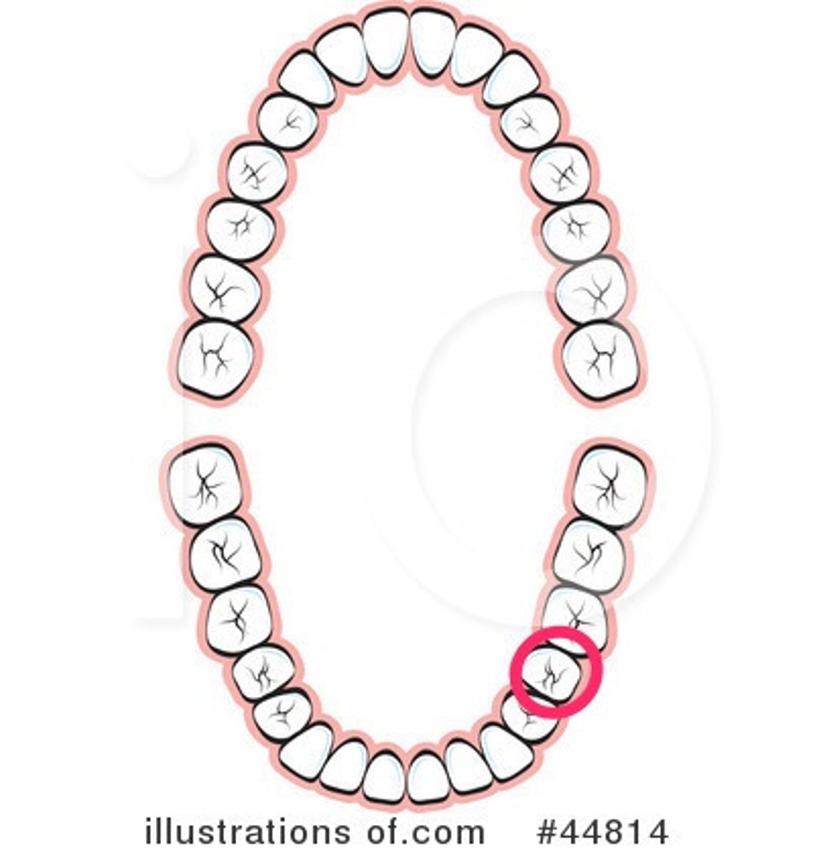 <p>LL 2nd premolar</p>