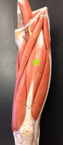 <p>Identify the Muscle.</p>
