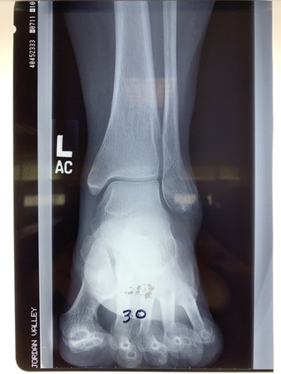 <p>acceptable</p><p>2 multiple choice options</p>