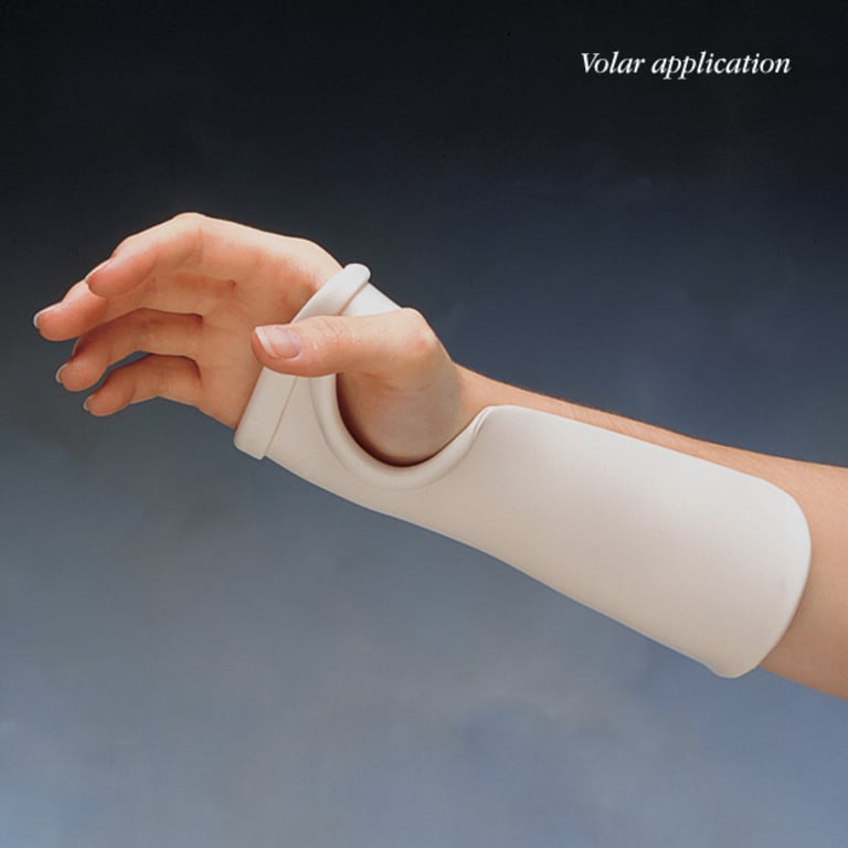 <p>Day splint for C1-C4 that provides wrist extension with forearm support, wrist neutral to 30 degrees extension, supports arches, fingers are free, custom fit</p>