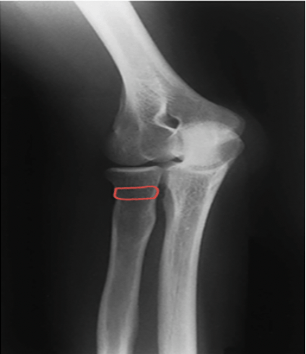 <p>What structure is highlighted?</p>