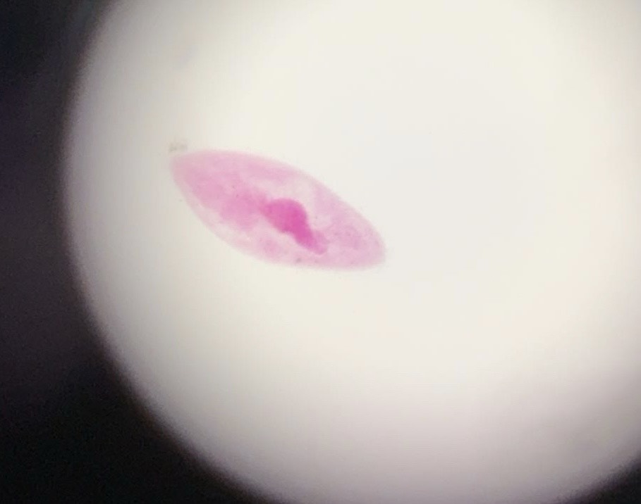 <p><span>What is this organism?</span></p>