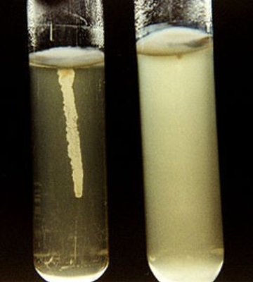 <p>Using semisolid agar to distinguish between motile bacteria</p><ul><li><p class="p1">growth (after 48hrs) observed as</p><ul><li><p class="p1">motile organism (right) = a turbid region extending from the stab</p><ul><li><p class="p1">bacteria will swim away from line to find nutrients causing cloudiness throughout medium</p></li></ul></li><li><p class="p1">Nonmotile bacteria (left) will only grow along the stab/incoulation line (no growth)</p></li></ul></li></ul><p></p>