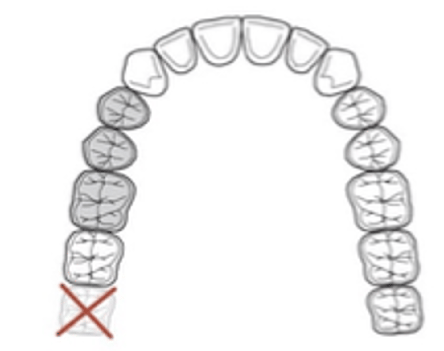 <p>Applegate’s Rules:</p><p>Rule 2. If a _____molar is missing and is not to be replaced, it is ______ in the classification</p>