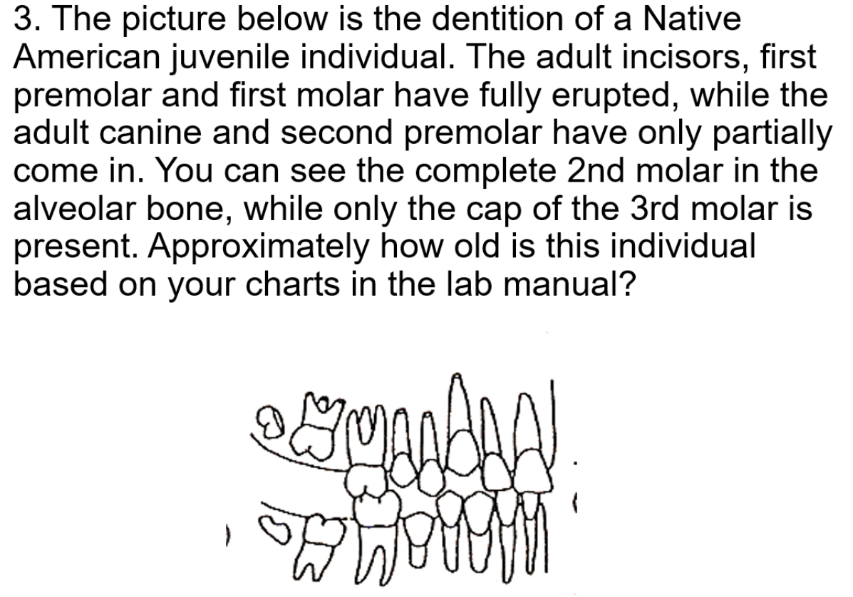 <p><span>Approximately how old was this Native American individual at death? </span></p>