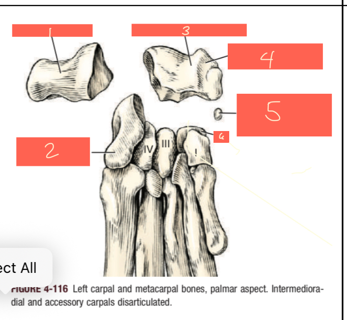 <p>Sulcus for tendon of flexor capi radialis</p>