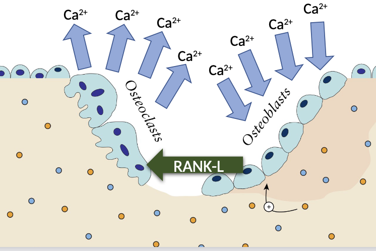 <ul><li><p><span>Myeloma cells release substances like </span><strong>RANKL</strong><span> (Receptor Activator of Nuclear Factor κB Ligand), which </span><strong>activates osteoclasts</strong><span>.</span></p></li><li><p><strong>Increased in Osteoclast activity</strong></p></li><li><p><strong>Release of calcium in to the blood</strong></p></li></ul><p></p>