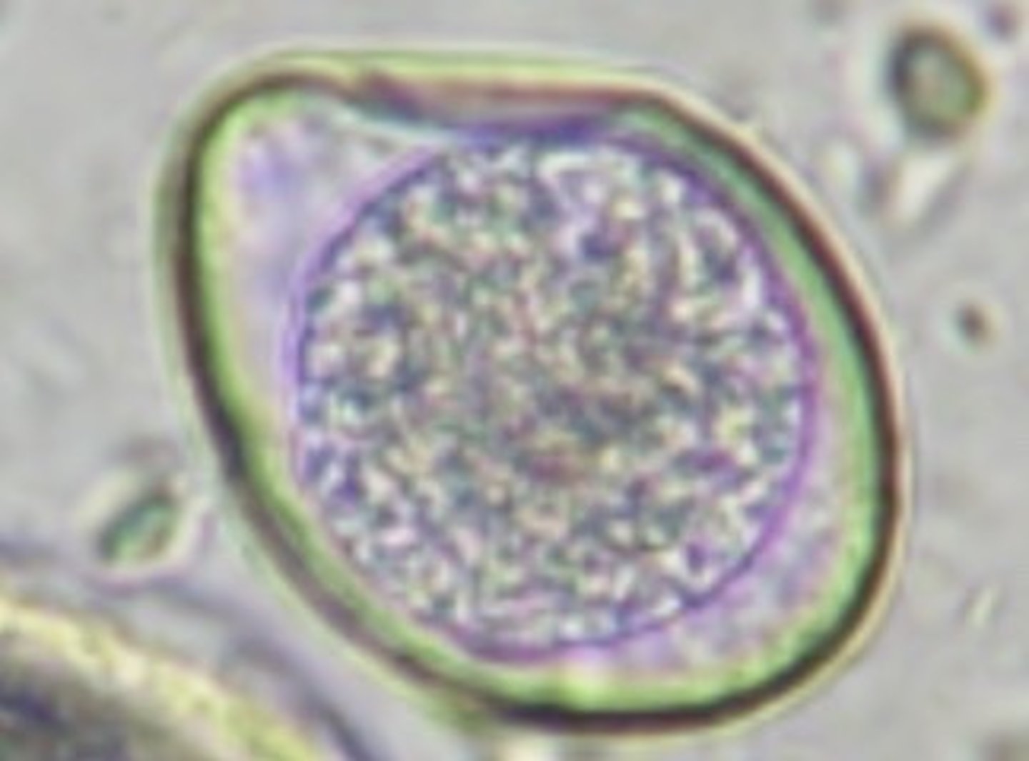 <p>Tear drop shaped parasite and how does it affect the health of host?</p>