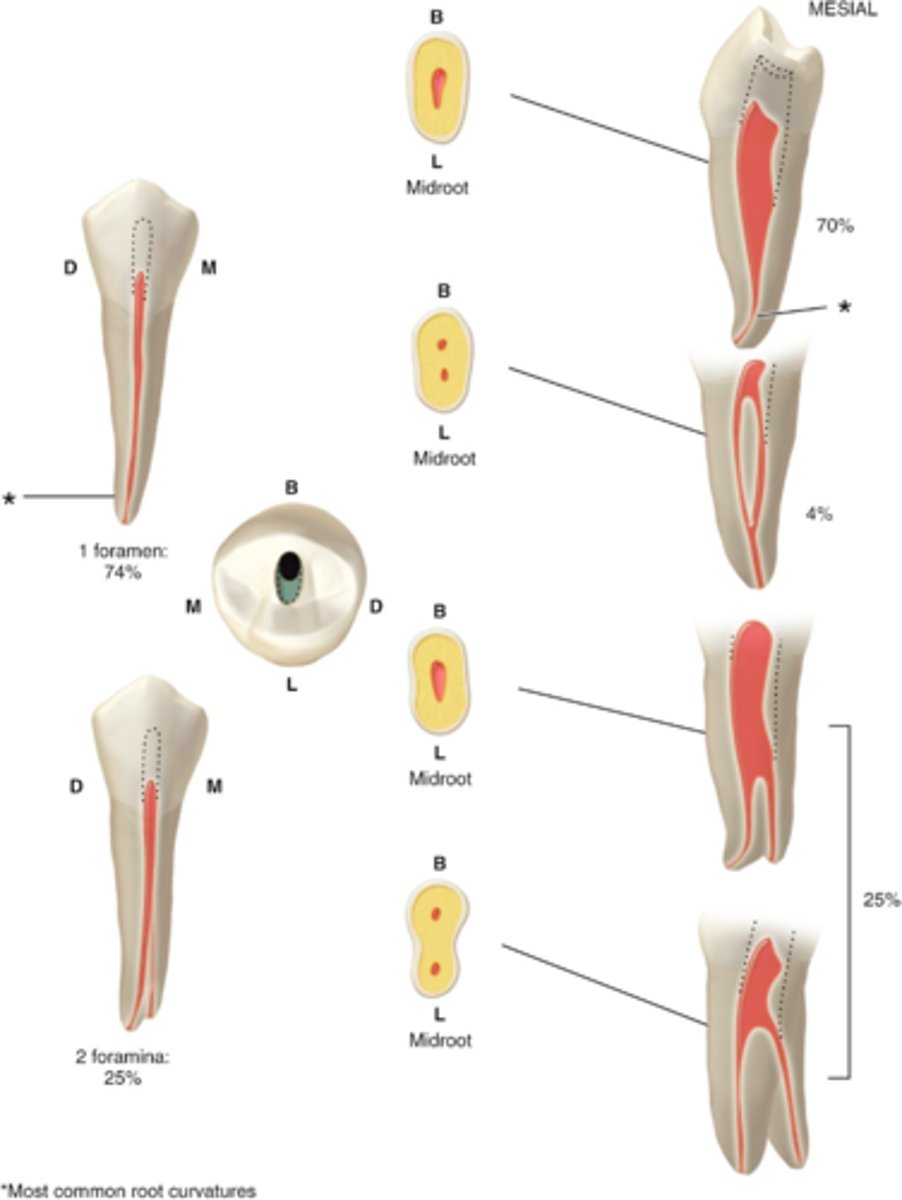 <p>mandibular first premolar access shape</p><p>*The apical portion of the roots of these teeth may vary greatly in form. This is not often seen on radiograph and requires thorough evaluation of the canal system.</p>