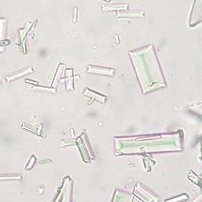 <p>What Crystal Is This? </p>