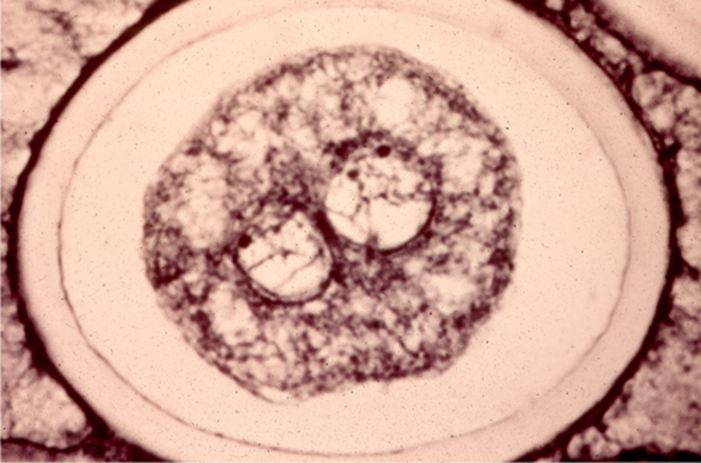 <p>In this image, the 2 _________ are fusing to form a ________ ________, or a ______.</p>