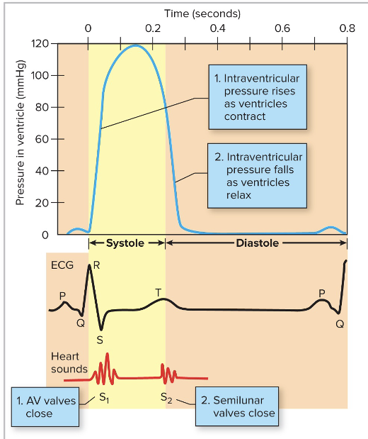 <ul><li><p>“Lub” occurs <strong>after the QRS wave</strong> as the AV valves close</p></li><li><p>“Dub” occurs at <strong>the beginning of the T wave </strong>as the SL valves close</p></li></ul><p></p>