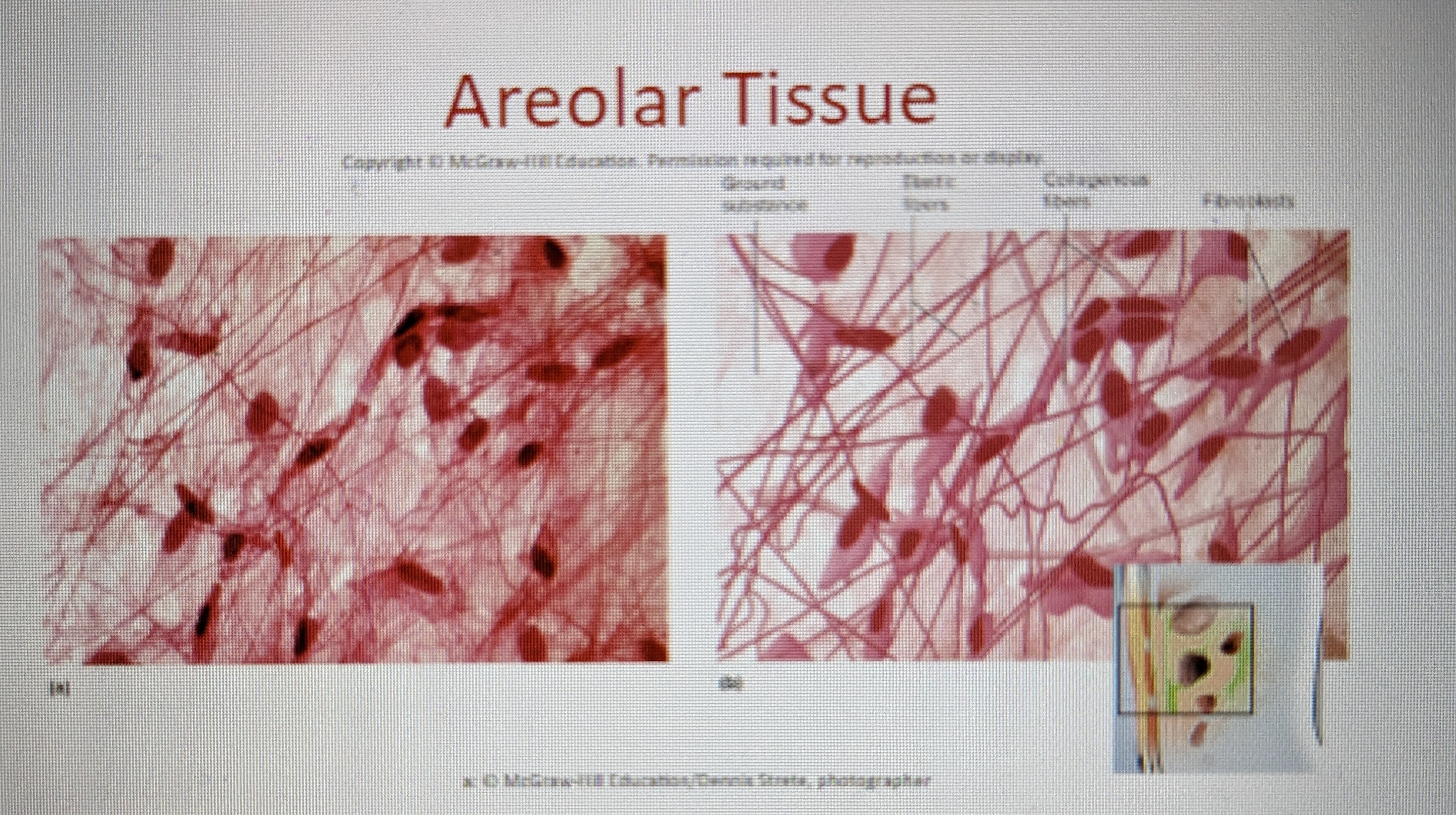 loosely organized fibers, abundant blood vessels, and a lot of seemingly empty space

* the general adhesive that helps hold us together, rubber cement
* possess all 6 cell types
* fibers run in random directions (most collagenous, elastic & reticular present)
* found in tissue sections from almost everywhere (surround blood vessels and nerves)
* nearly every epithelium rests on layer (blood vessels provide nutrition to epithelium & waste removal, ready supply of infection fighting leukocytes that move about freely in this tissue)  \\
* easy diffusion of nutrients, high rate of exchange, exchange a lot with avascular types 