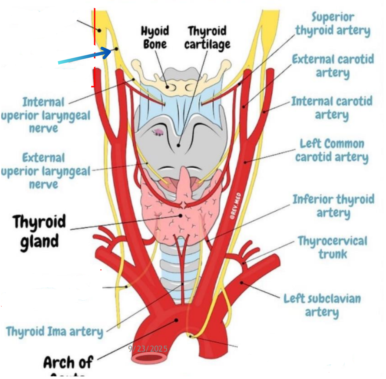 term image