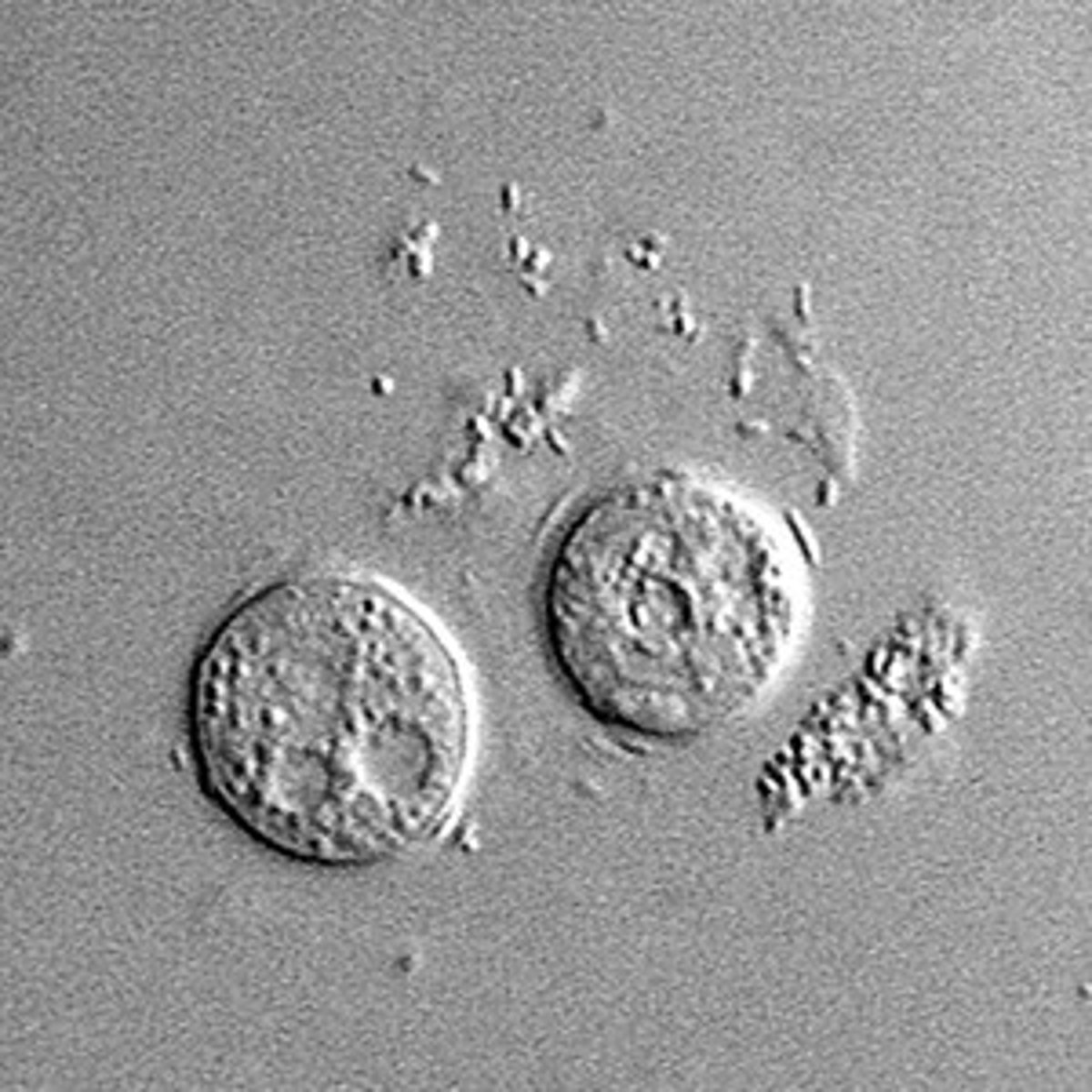 <p>-produces 3D image and layer by layer imaging of specimen</p>