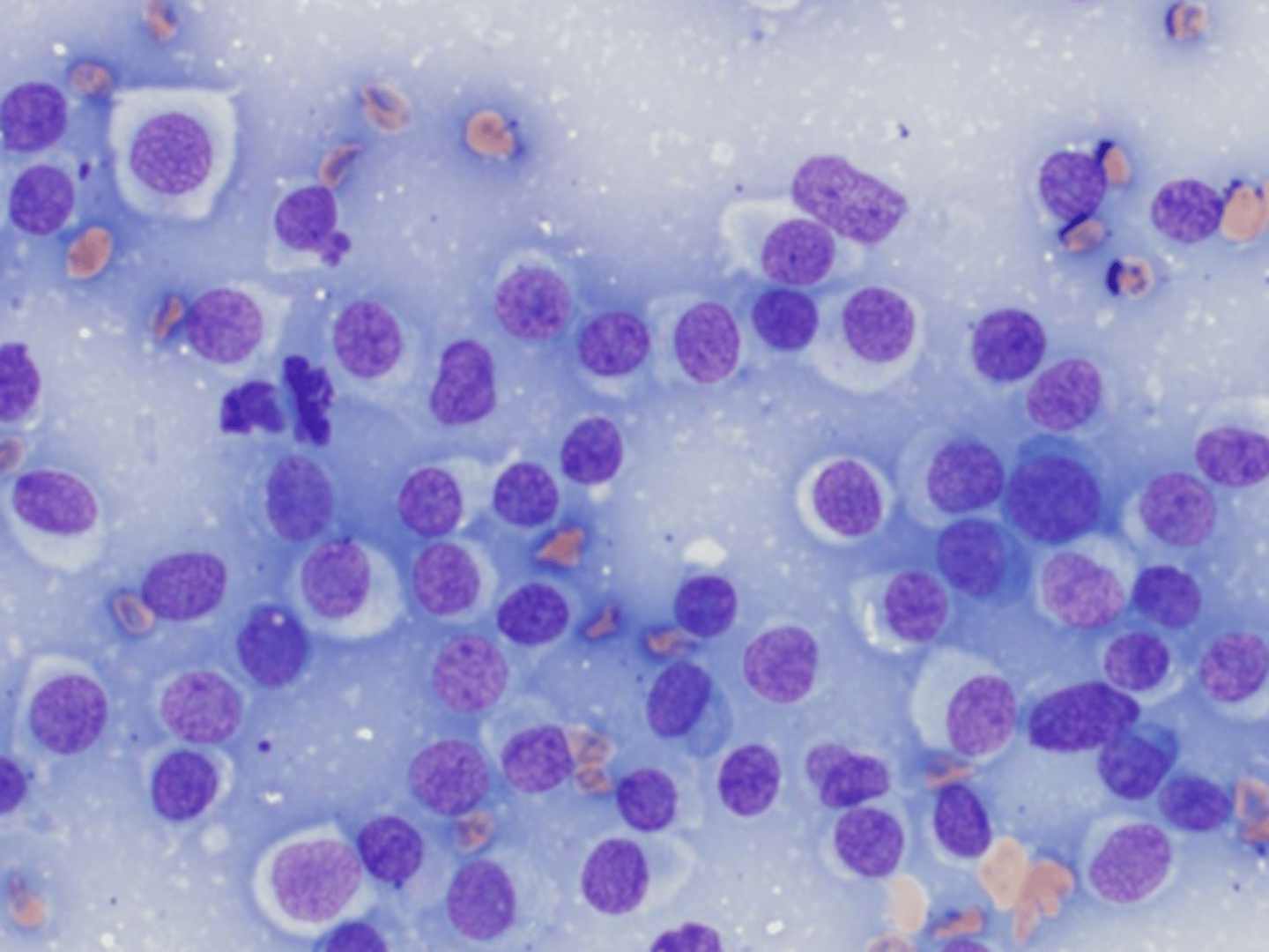 <p>Identify the type of round cell neoplasia?</p>