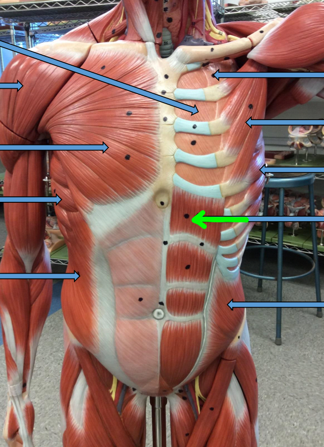 <p>Identify this muscle?</p>