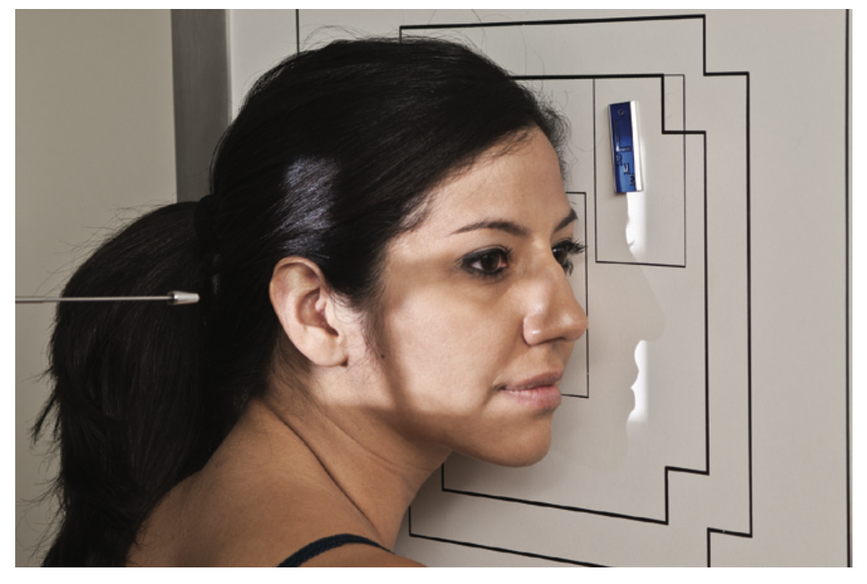 <p>What is the <u>CR</u> for <strong>RT and LT lateral </strong>for <strong>sinuses?</strong></p>