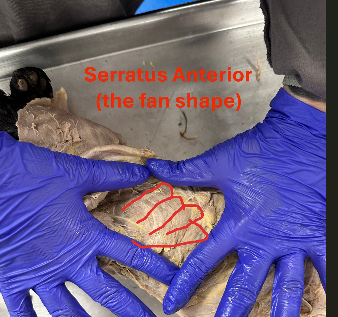 <p>Serratus anterior ( shoulder and back deep muscle)</p>