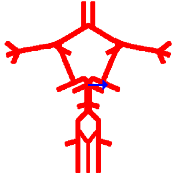 <p>Label this cerebral artery</p>