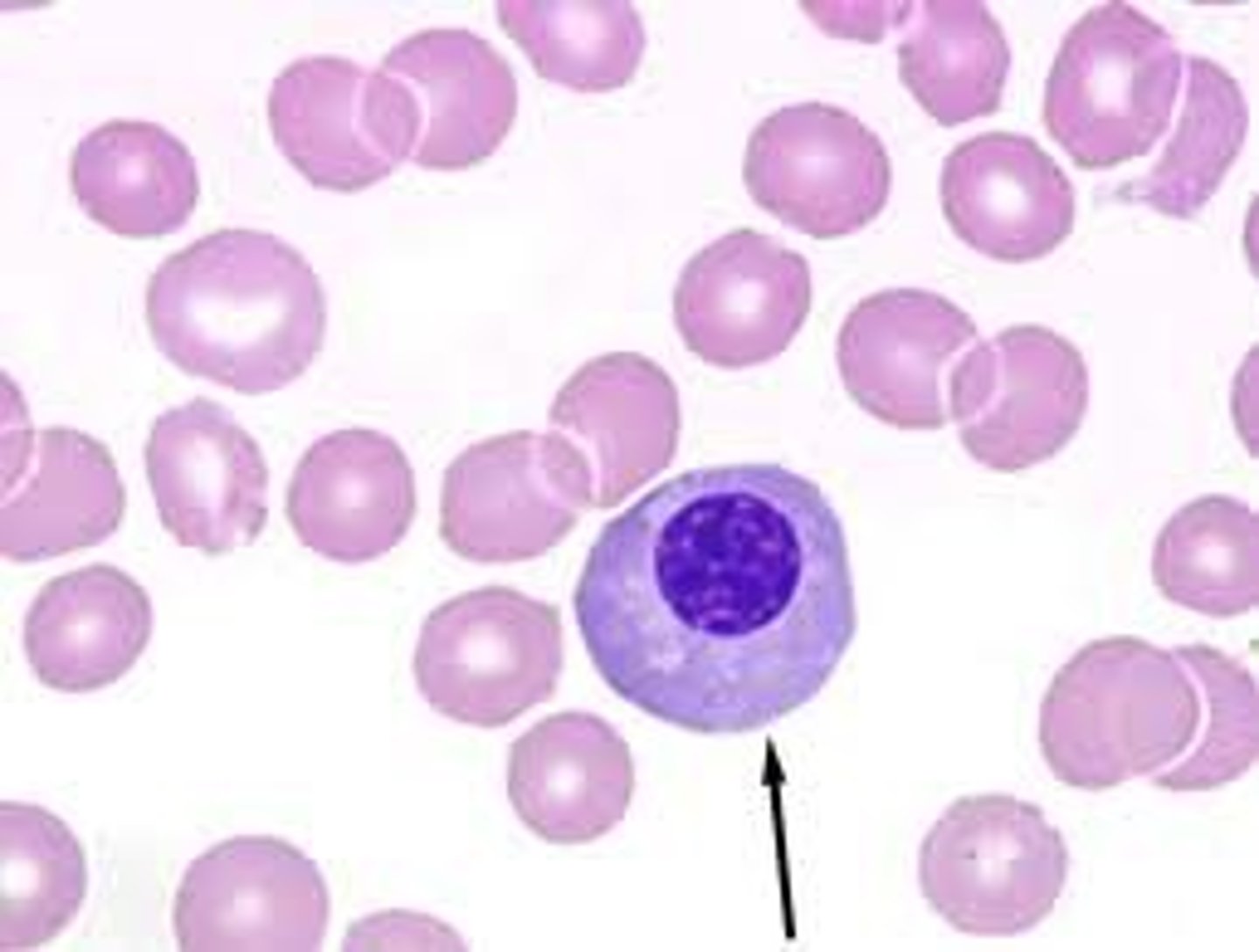 <p>Rubricyte/ Polychromatic normoblast/ polychromatic erythroblast<br>- 60% nucleus<br>- nucleus is almost completely clumped<br>-gray cytoplasm<br>- 3-5% BM</p>
