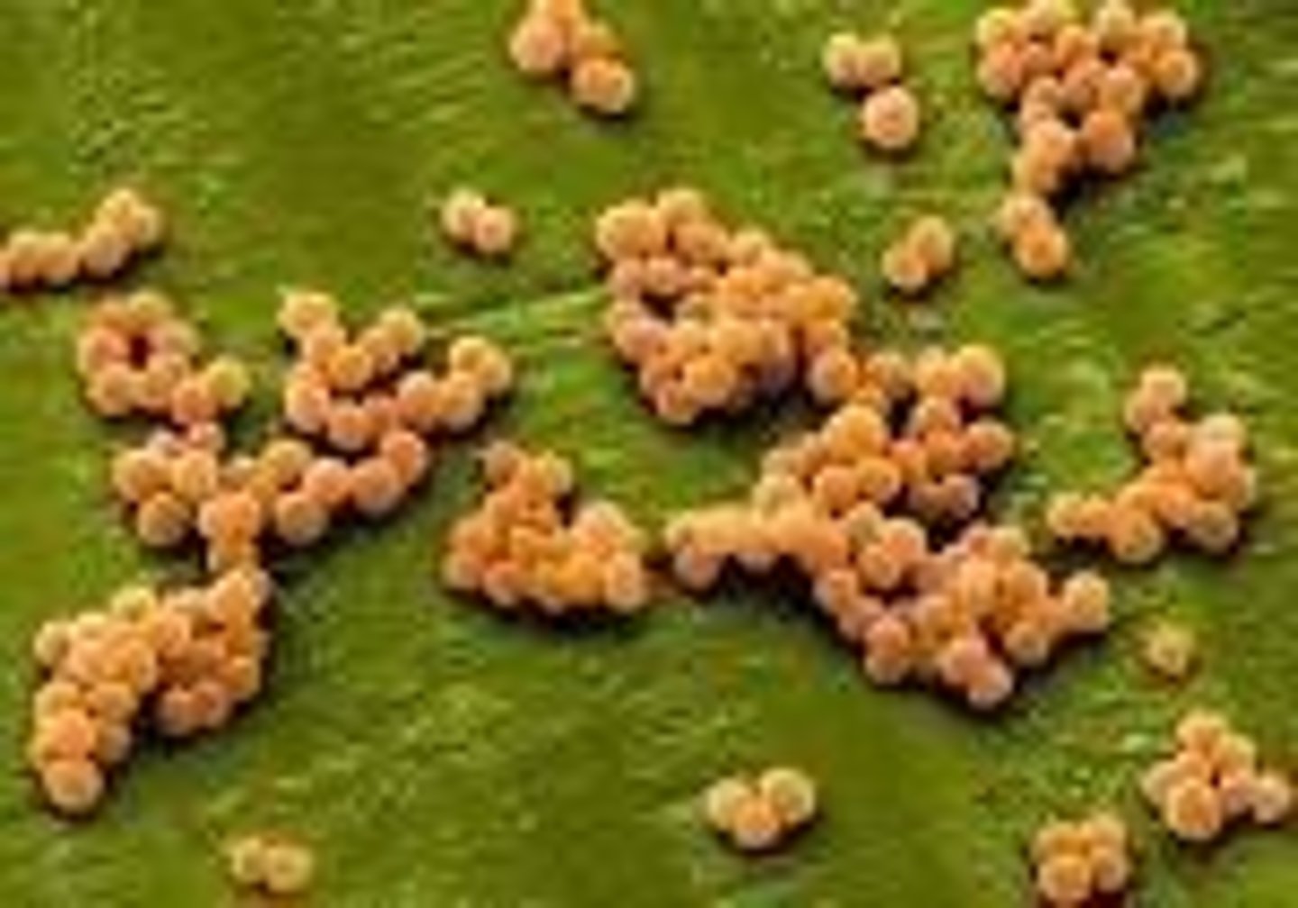 <p>Prokaryotic cells that lack peptidoglycan in their cell walls.</p>