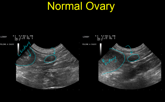 <p>Normal reproductive system on Ultrasound</p>