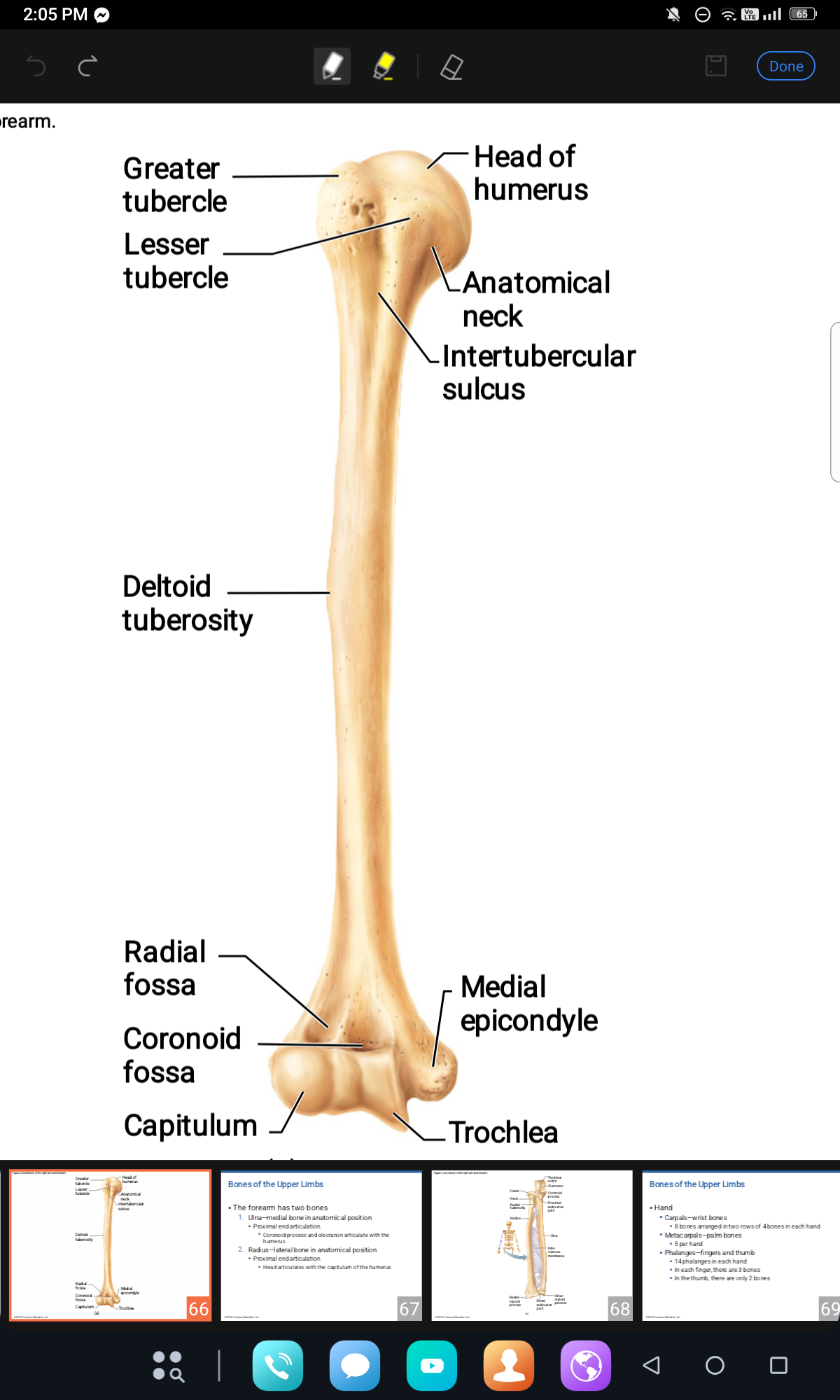 <p>Deltoid tuberosity, Lesser Tubercle, Greater Tubercle </p>