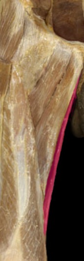 <p>medial part of thigh, narrow band</p>