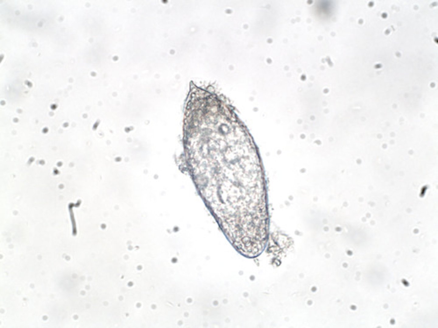 <p>- Ciliated larvae stage found in trematodes that bore into the snail</p>