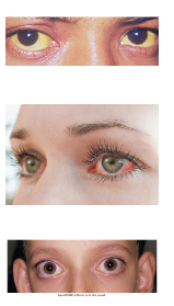 <p>Eyes </p>