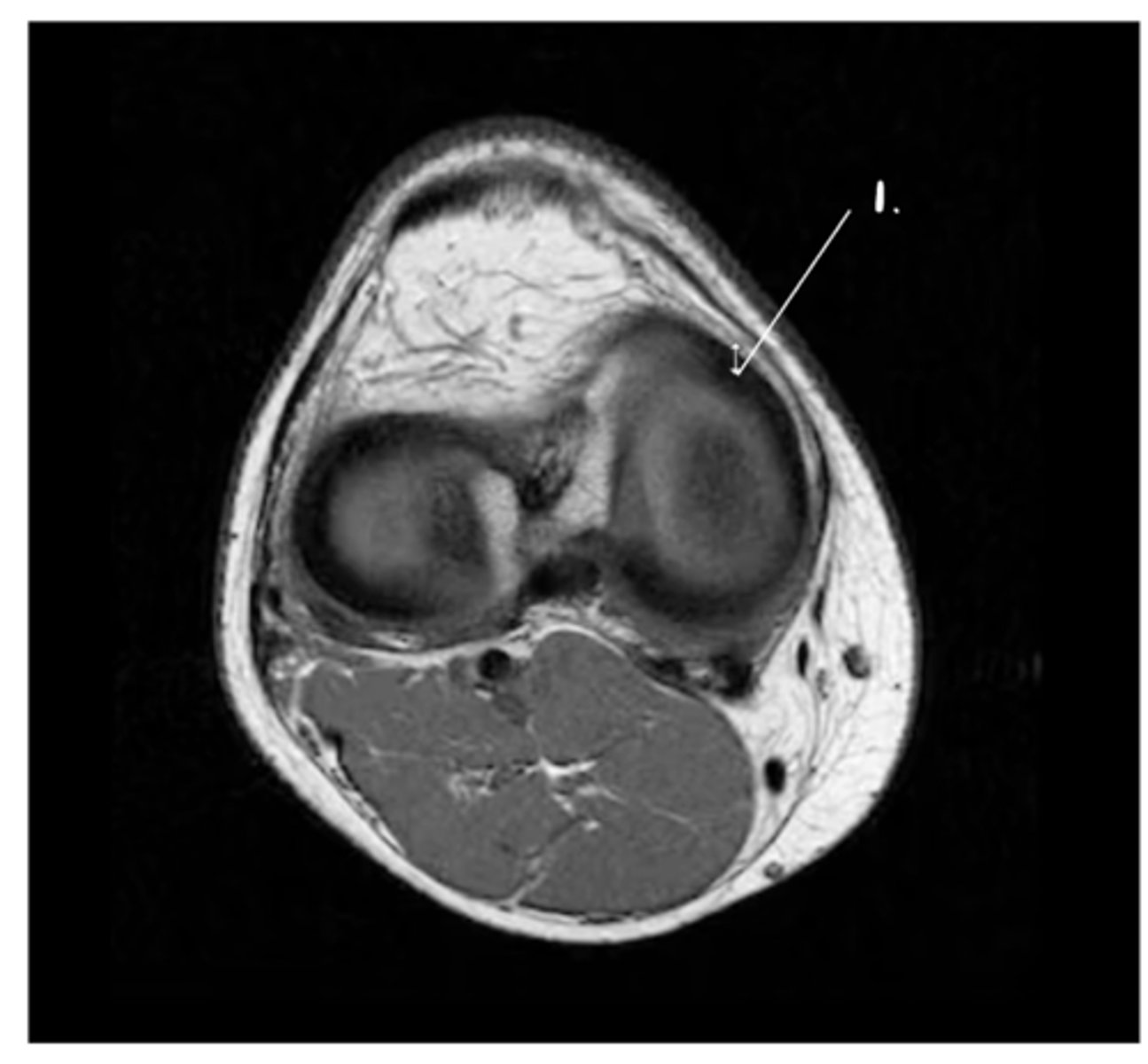 <p>Label this structure.</p>
