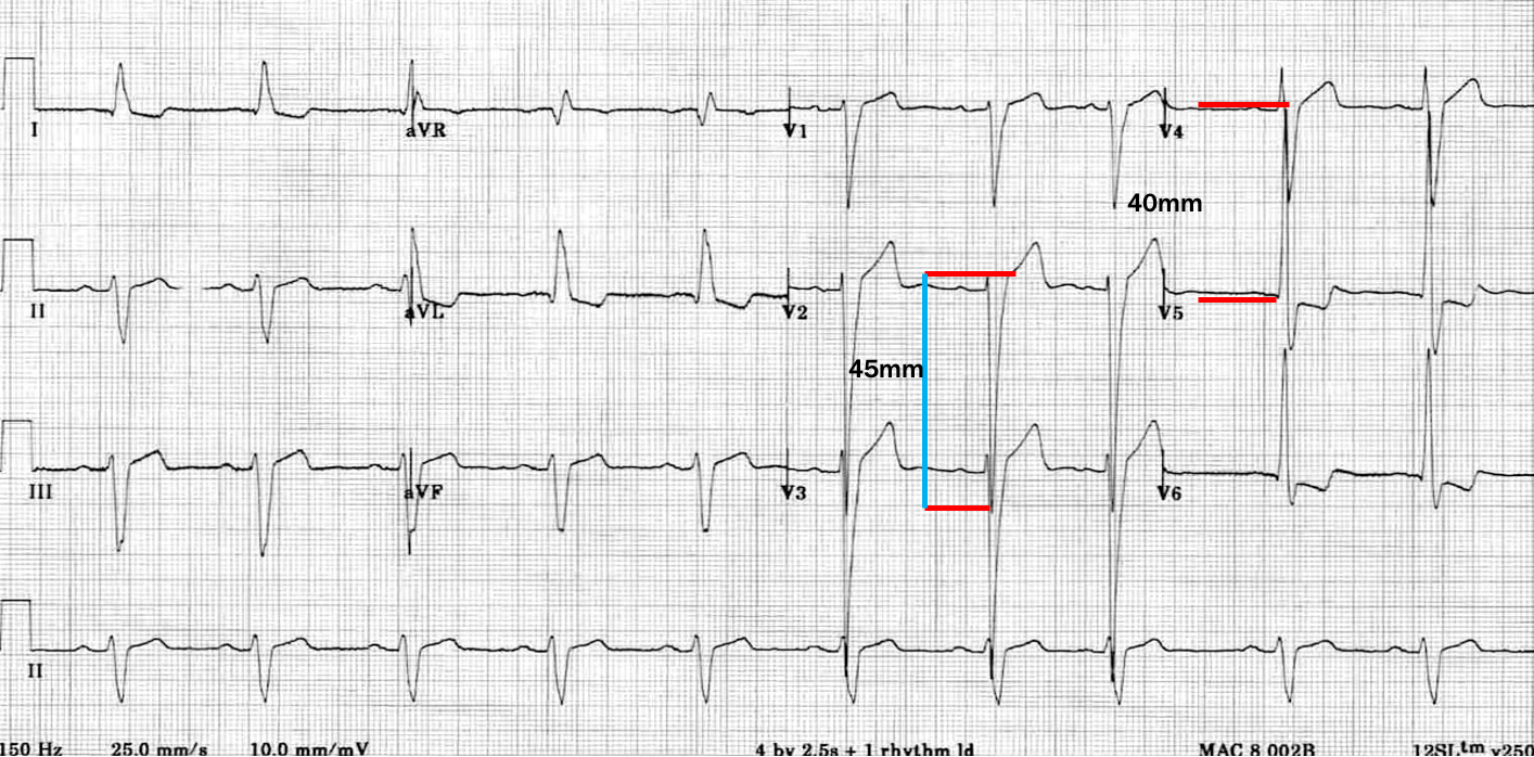 <p>what is this?</p>