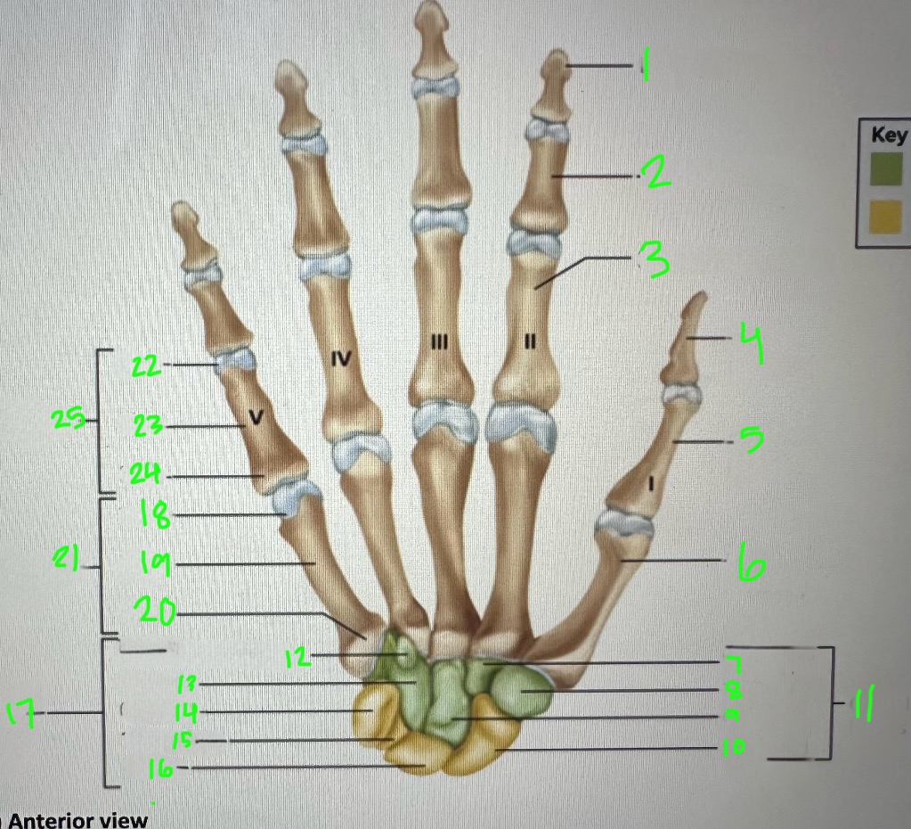 <p>pisiform</p>