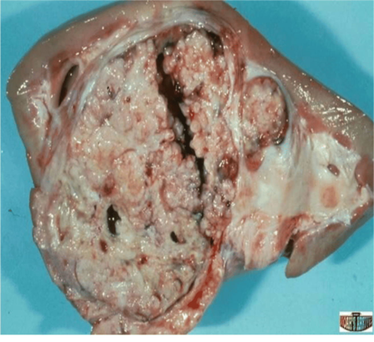 <p>Embryonal kidney tumor with high metastatic rate in dogs &lt;2 years</p><p>Found incidentally at slaughter in cattle, pigs, and poultry</p>