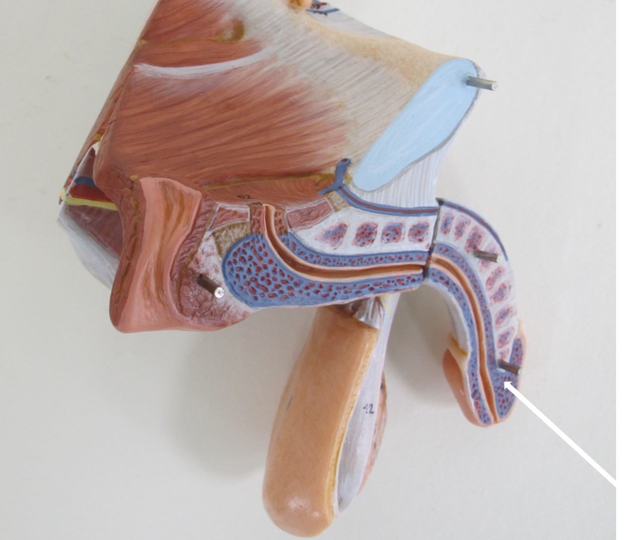 <p>verbreding penis</p>