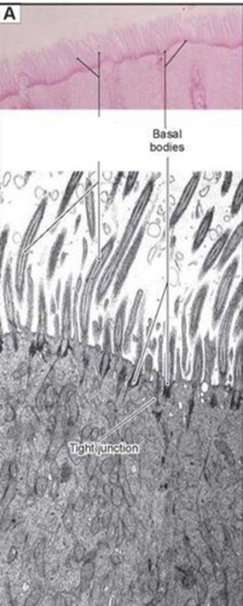 <p>What apical surface projection is this?</p>